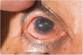 Sensory organ care